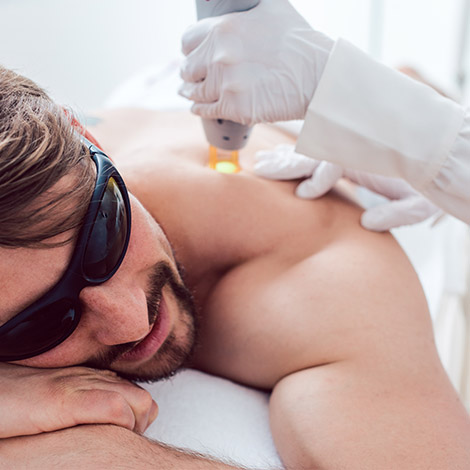 Men Hair Removal Tips: Waxing and Laser